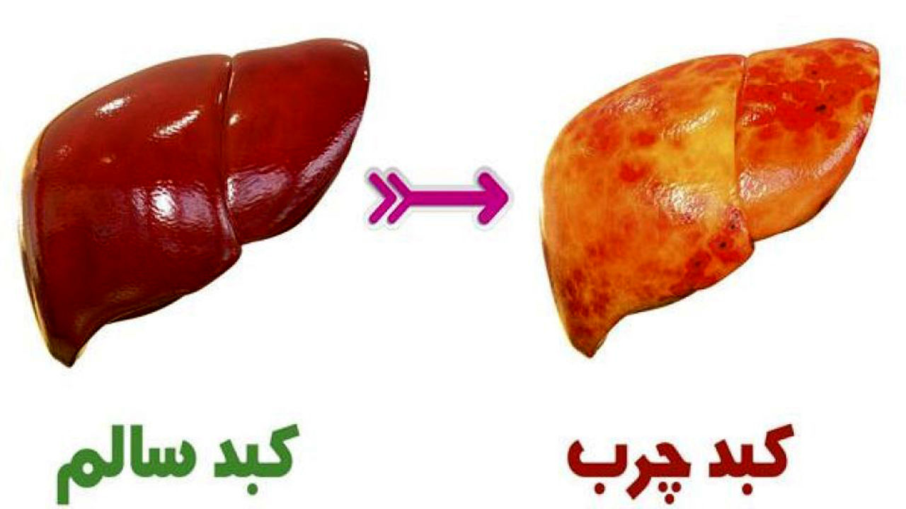 میوه های مفید برای کبد چرب