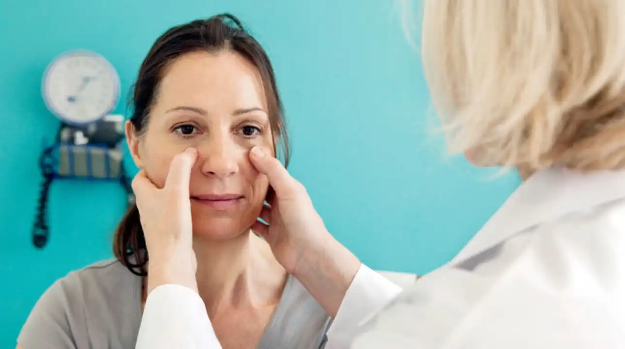 سینوزیت چیست؟