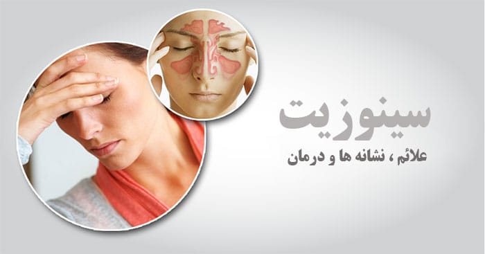 سینوزیت چیست؟