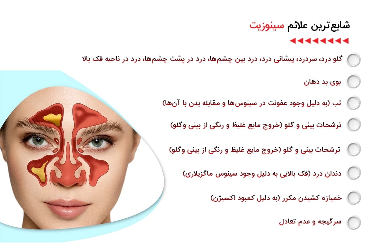 سینوزیت چیست؟