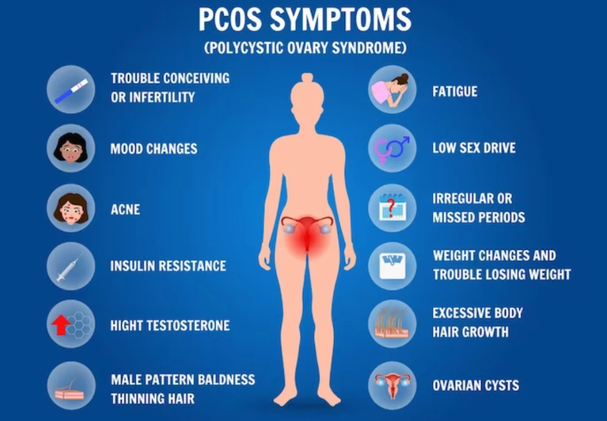 درمان تنبلی تخمدان