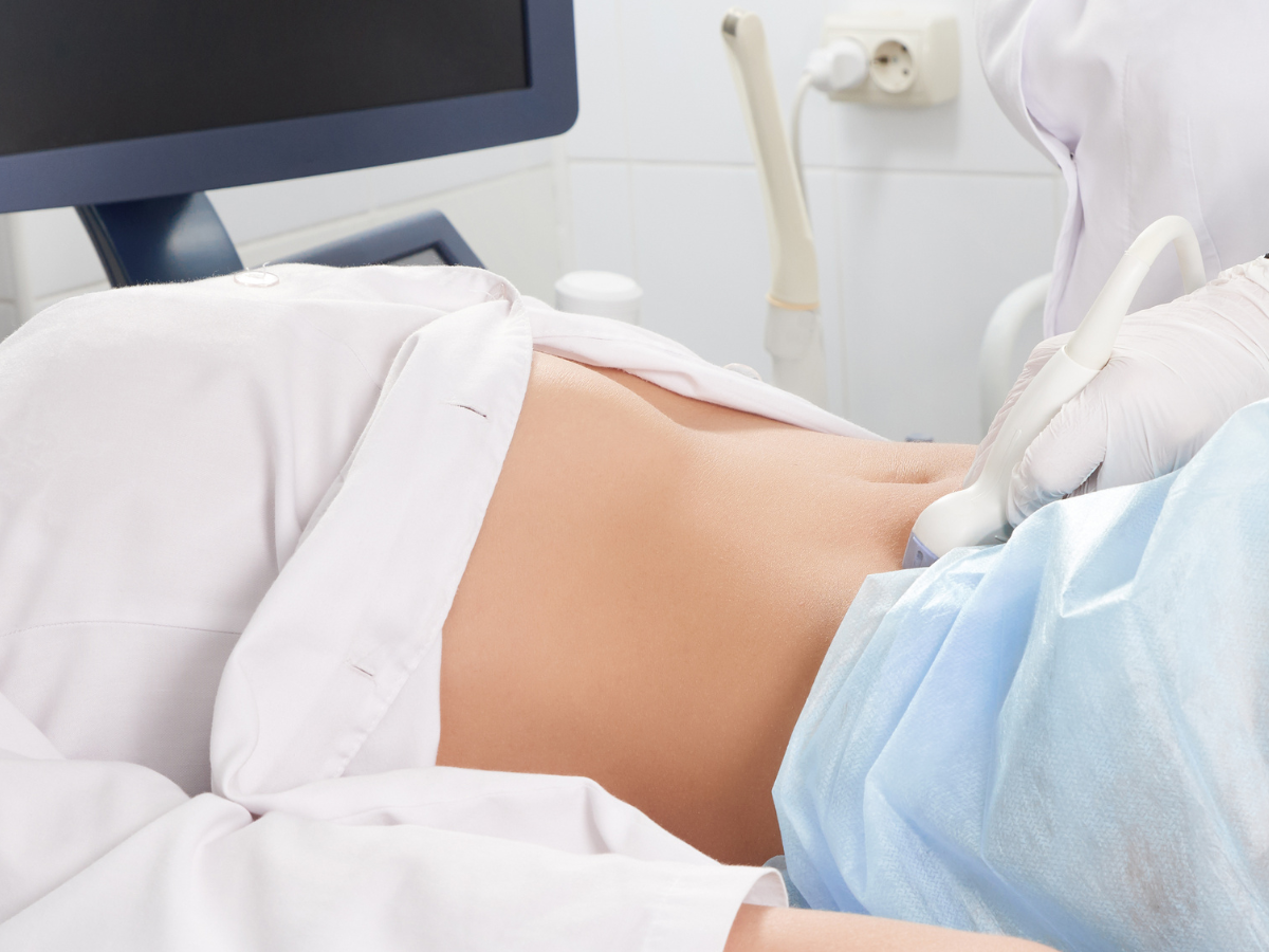 درمان تنبلی تخمدان